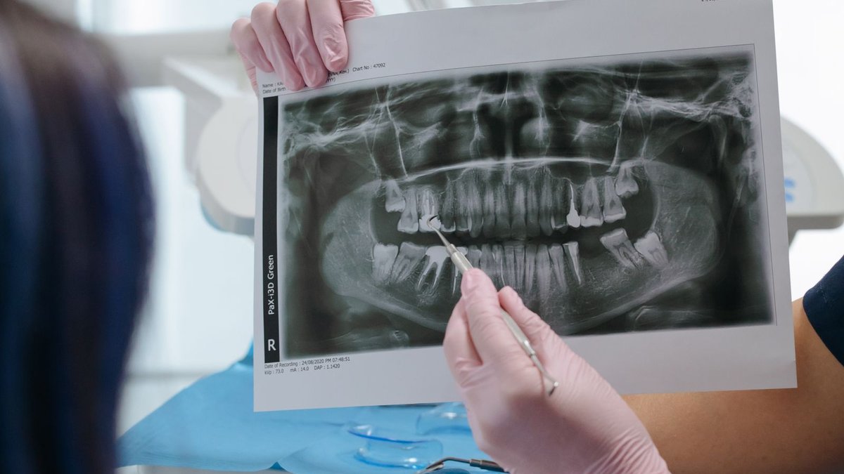 A dentist holding up a panoramic dental X-ray and pointing to a finding