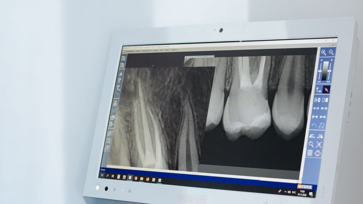 Dental X-ray images displayed on a clinic monitor during reporting