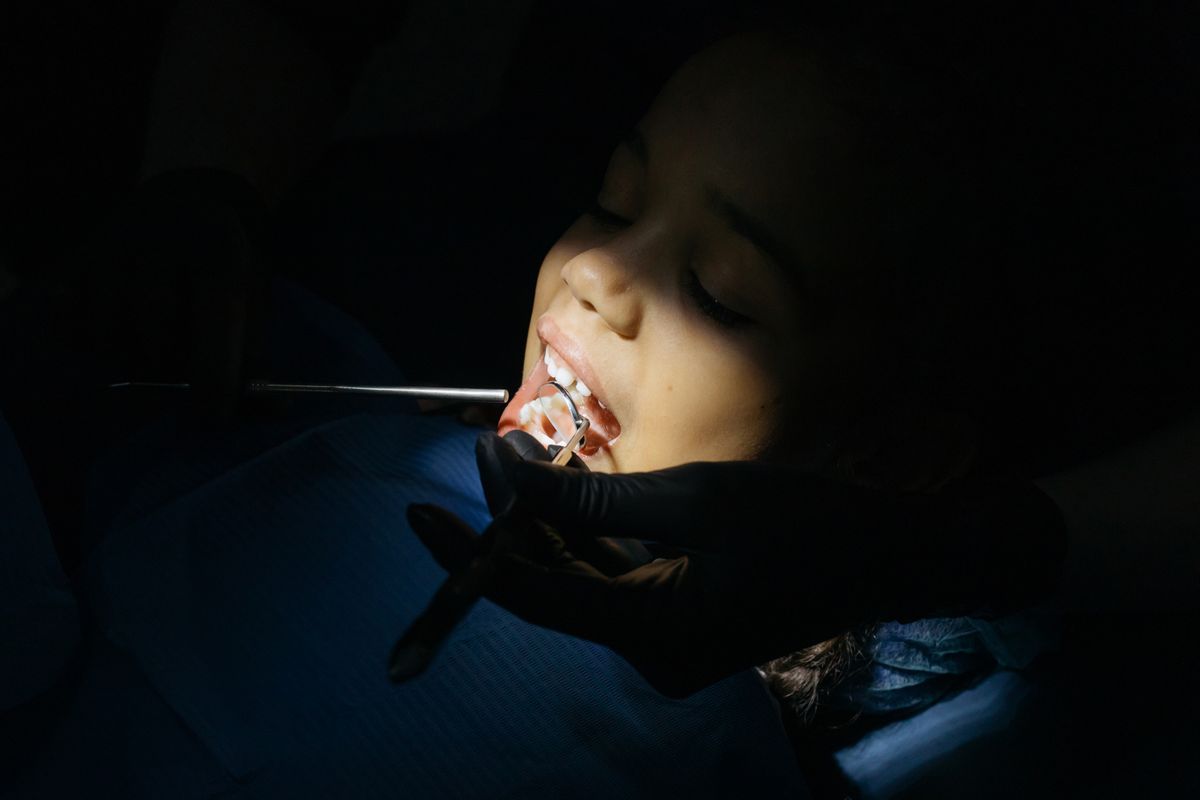 A young child receiving dental treatment on a back tooth that may need a stainless steel crown