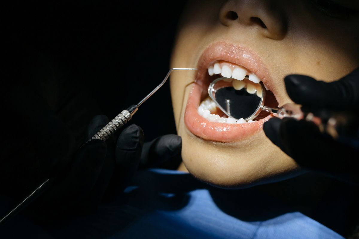 Close up of a pediatric dental examination assessing a tooth for a possible pulpotomy