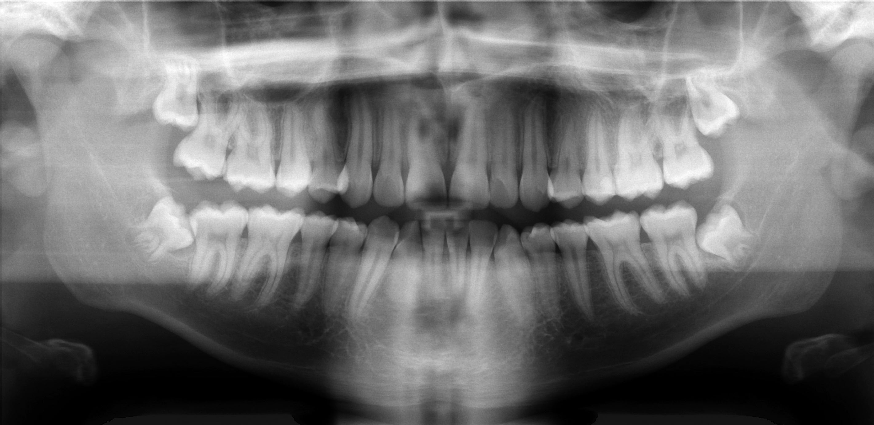 Panoramic dental X-ray — the kind of imaging an independent reviewer reads alongside your written treatment plan to verify each recommended procedure
